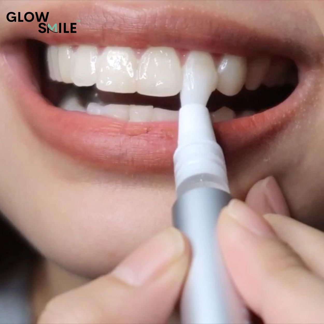 Kit De Blanchiment GlowSmile™